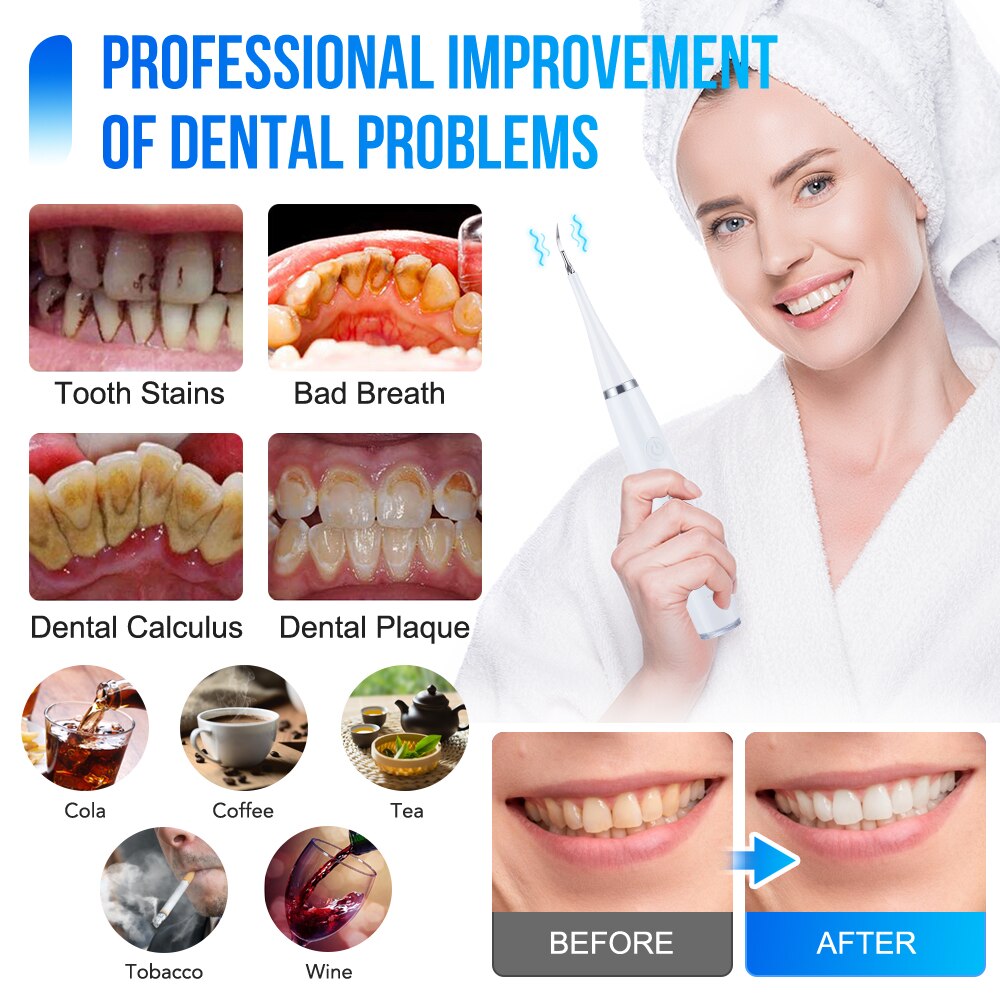 Electric Dental Calculus Remover Dental Cleaning Device