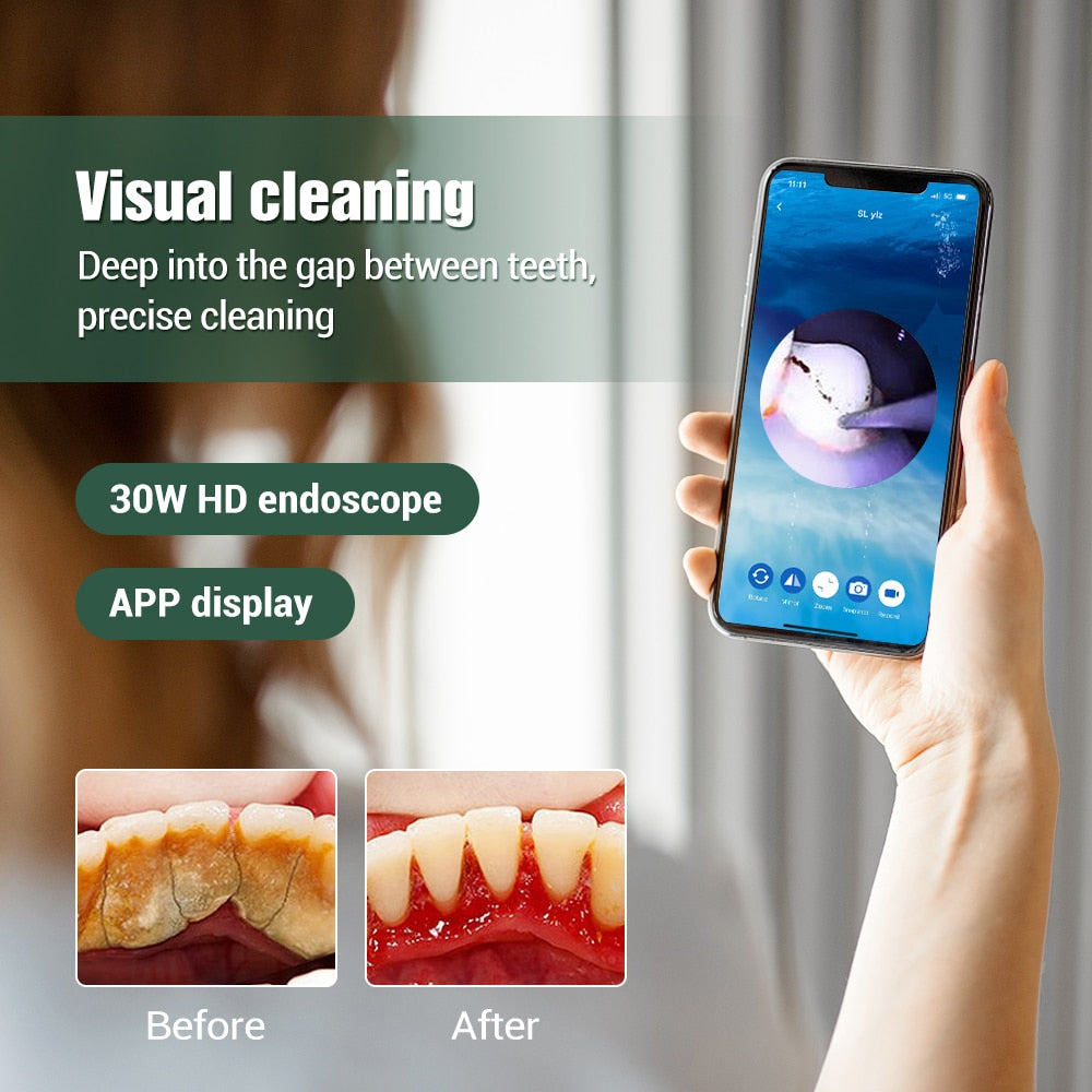 Household Tooth Whitening Device